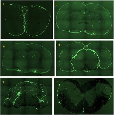 The Configuration of the Perivascular System Transporting Macromolecules in the CNS